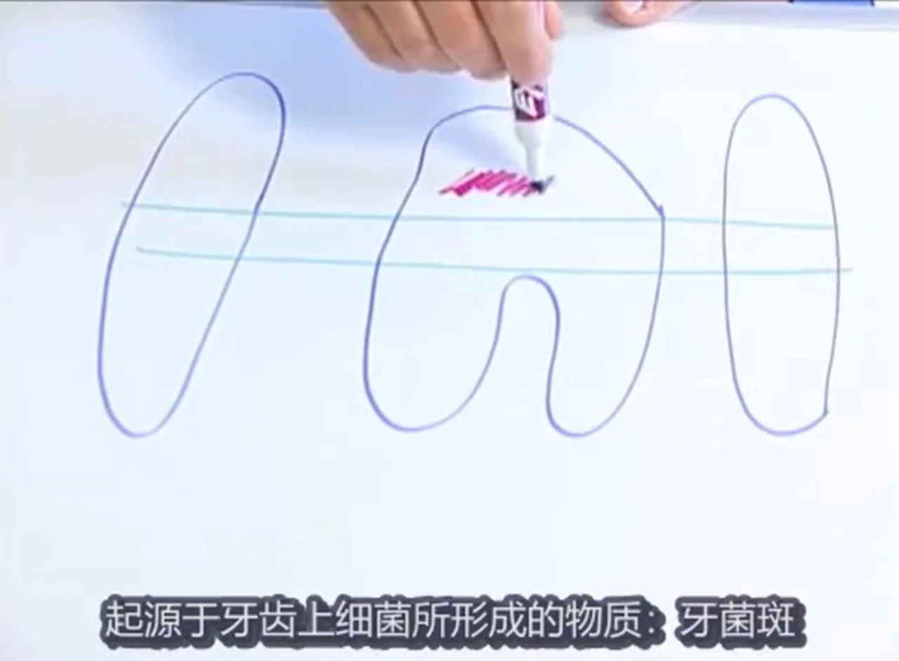 怎么给猫刷牙是正确的,给猫刷牙的正确方式