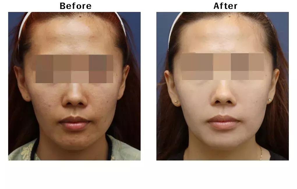 宋慧乔为何可以红这么多年,宋慧乔何穗惊艳亮相