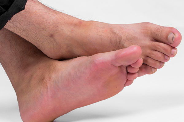 脚趾甲总往肉里长怎么办?其实用点棉花就可轻松解决,走路不再疼