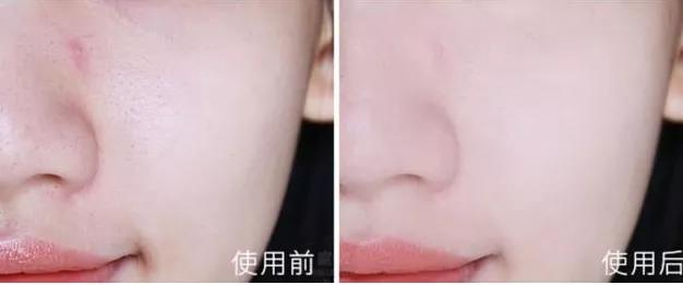 毛戈平遮瑕手法李佳琦 (毛戈平遮瑕李佳琦)