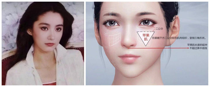 改善颧骨的10个方法,颧骨美学