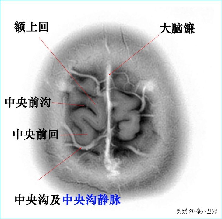脑解剖学讲解视频全集,脑功能解剖学习