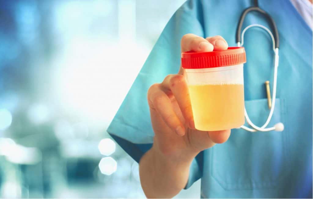 尿糖与糖尿病的区别,糖尿病人尿糖四个加号意味着什么