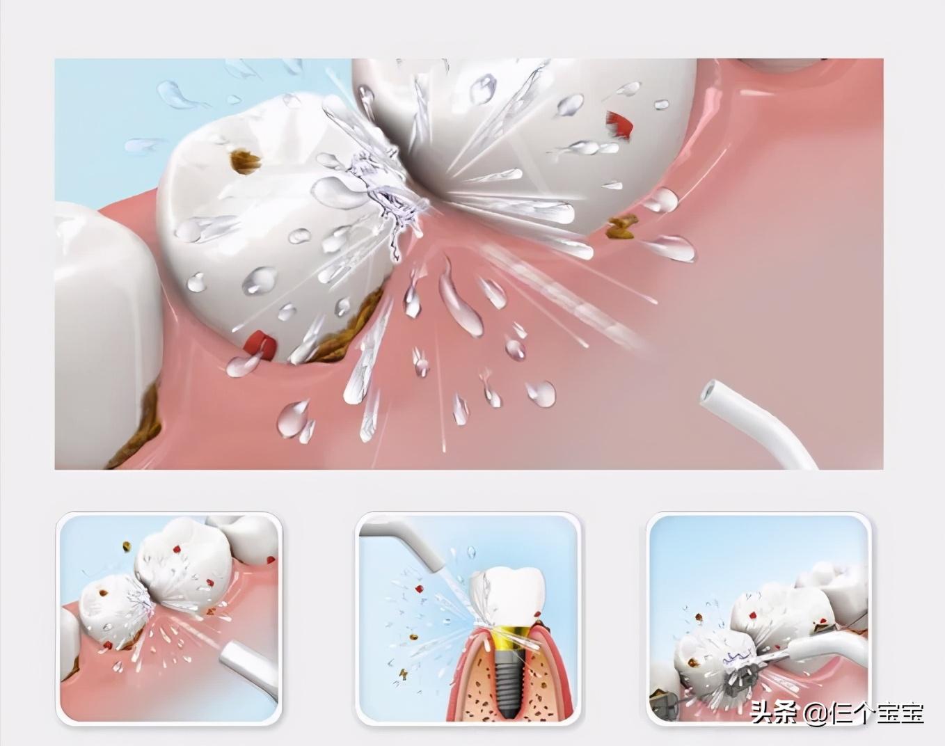 草莓籽藏在牙里发芽了,草莓籽在嘴里发芽