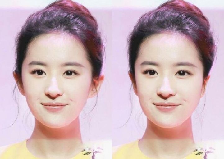 20万玻尿酸,一连打6支玻尿酸会怎么样