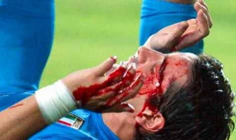 韩国足球最脏的比赛,韩国足球真的脏