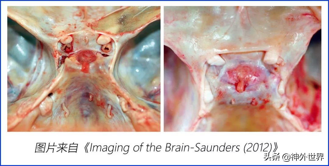 鞍区解剖学习笔记之——垂体
