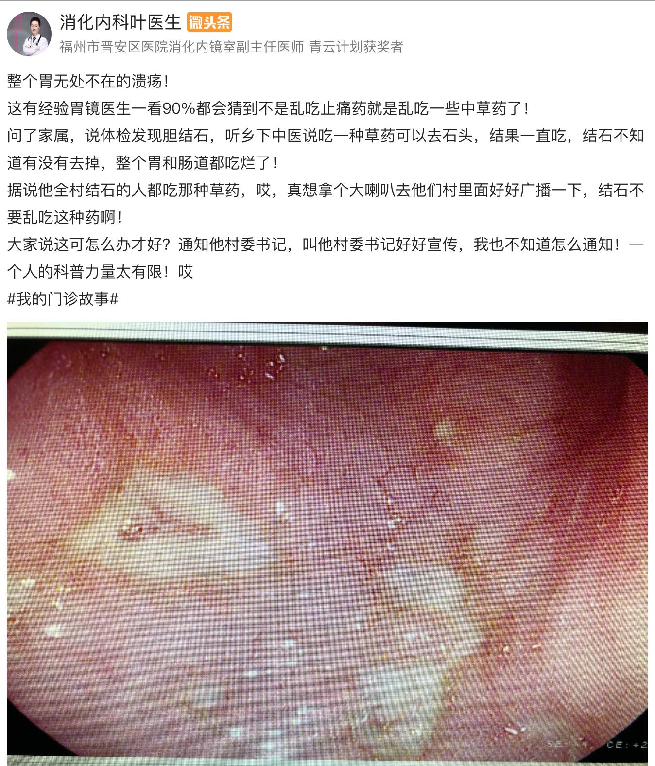 胃为什么吃得太饱就反酸顶气,胃为啥消化那么快