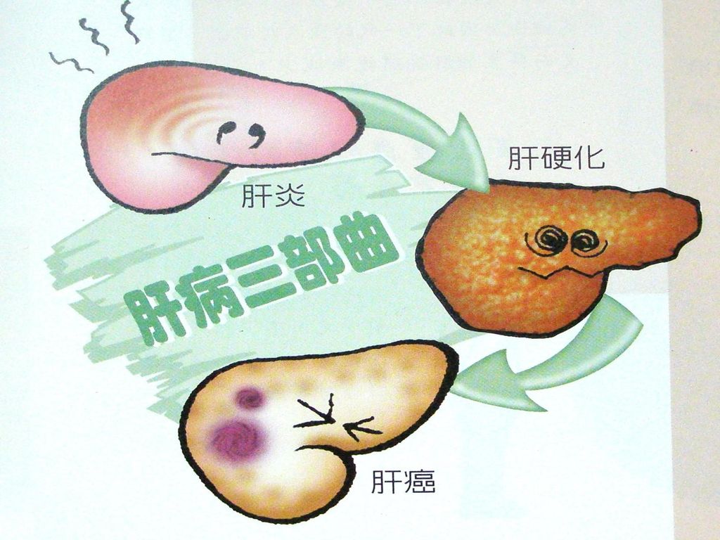 甲胎蛋白超出正常值一点点,甲胎蛋白检查肝脏疾病准确率高吗