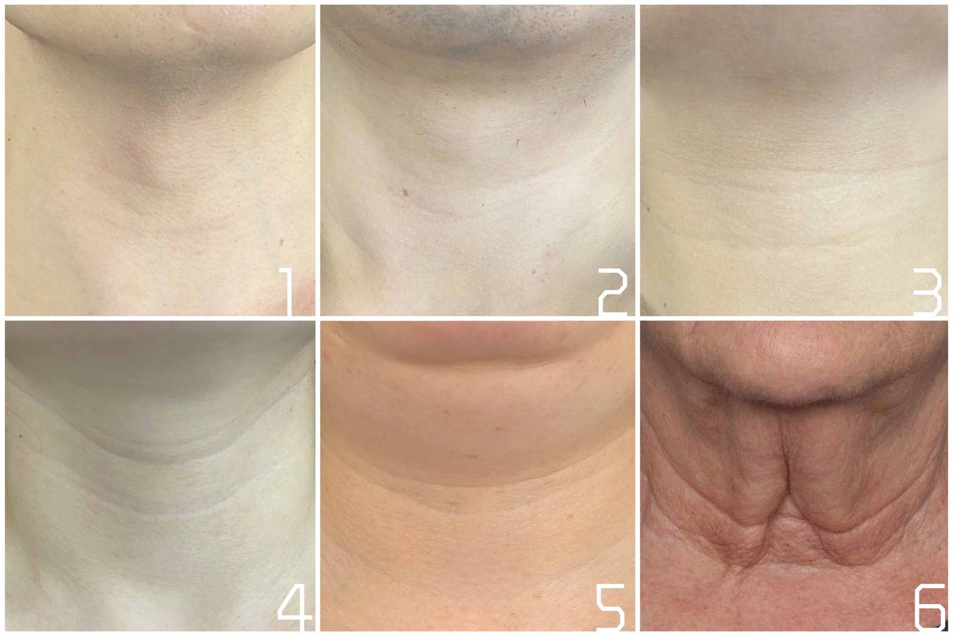 脖子的颈纹怎么美颜,脖子有颈纹怎么弄好看点