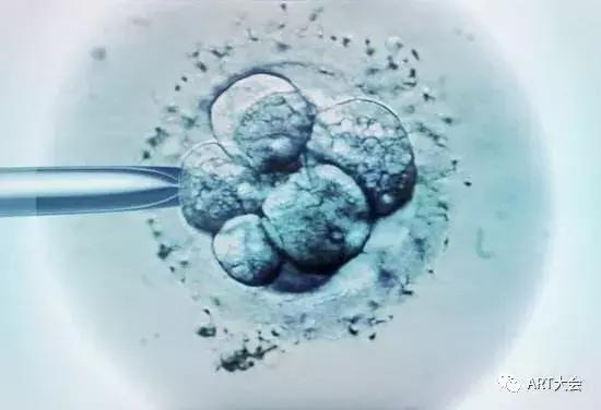 中国高龄不孕女性辅助生殖临床实践指南