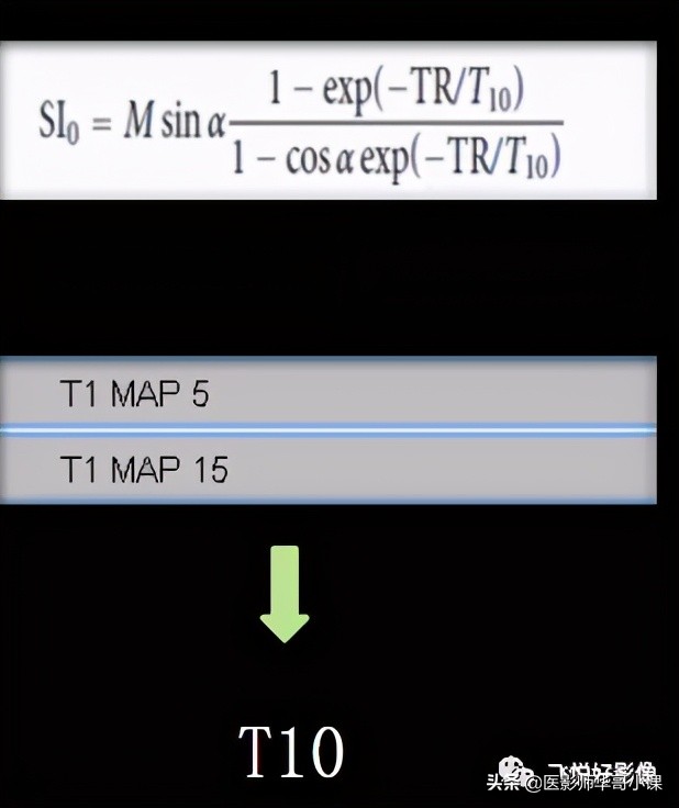 「飞利浦磁共振技术」DCE技术原理及应用（二）