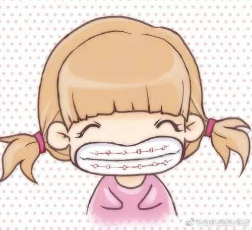 矫正牙齿戴牙套好还是隐形牙套好,牙齿矫正用隐形牙套还是传统牙套