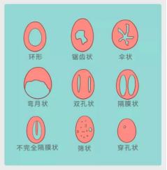 说一个你内心难以启齿的小秘密,女生有哪些让你难以启齿的病