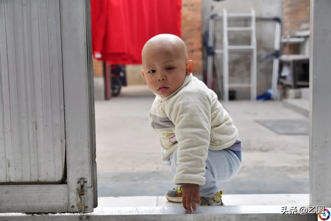 世上最悲催的婴儿,人间悲惨的孩子