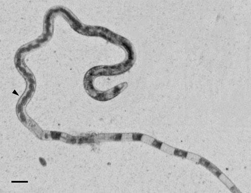 日本人生鱼片寄生虫发病,吃生鱼片弓形虫感染