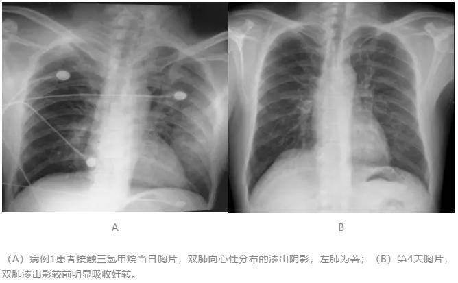 工人用稀料清理泡沫10分钟即意识丧失，肝功能异常是否为切入点？