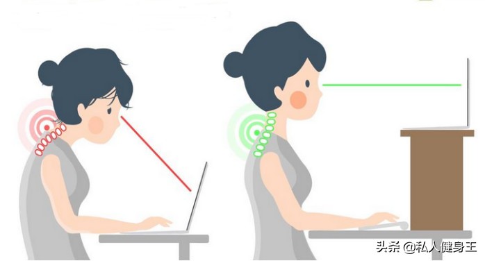 驼背很严重如何矫正,40年驼背站墙根纠正驼背可以吗