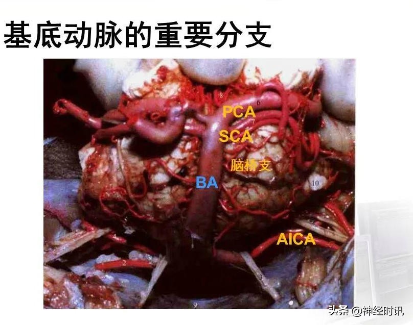 脑动脉解剖学讲解,基底节区脑血管解剖