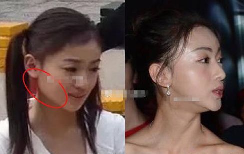 那些削骨的女明星怎么样了,哪些明星承认削骨了