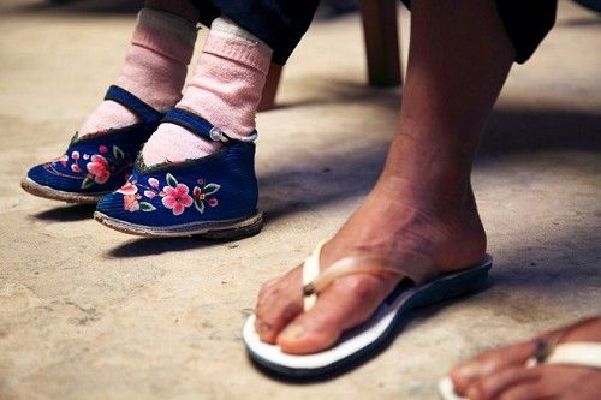 女人有轻微的自残现象,女人有自残现象