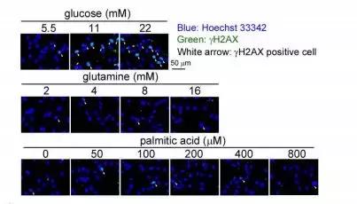 乔布斯的癌症治疗方法,乔布斯爱吃水果