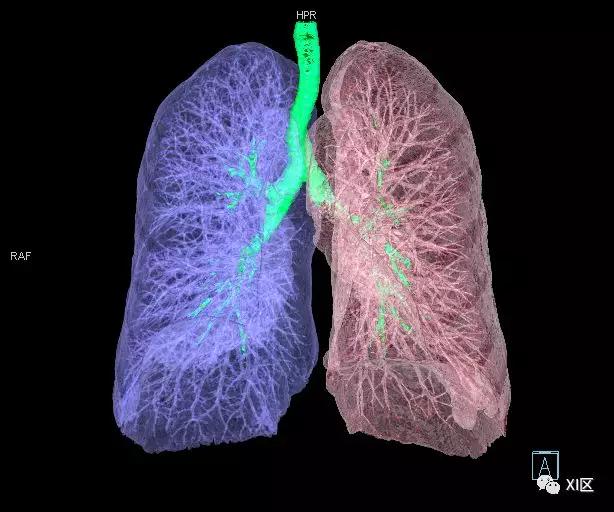 如此详细的肺部影像解剖，有点儿酷