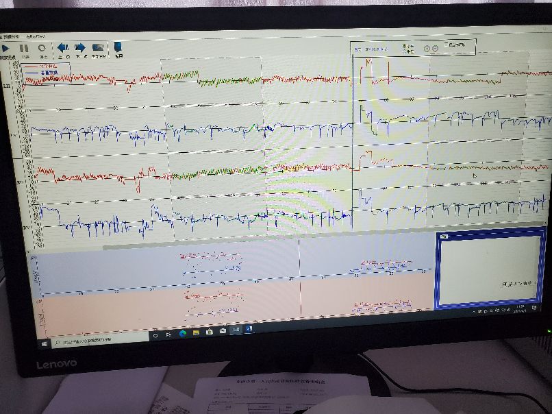 老年人颈椎病引起头晕恶心呕吐,头晕恶心干呕是不是颈椎病