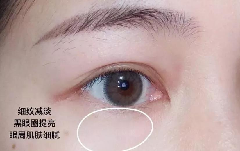 兰蔻和雅诗兰黛小棕瓶眼霜哪个好,雅诗兰黛小棕瓶眼霜和兰蔻哪款好