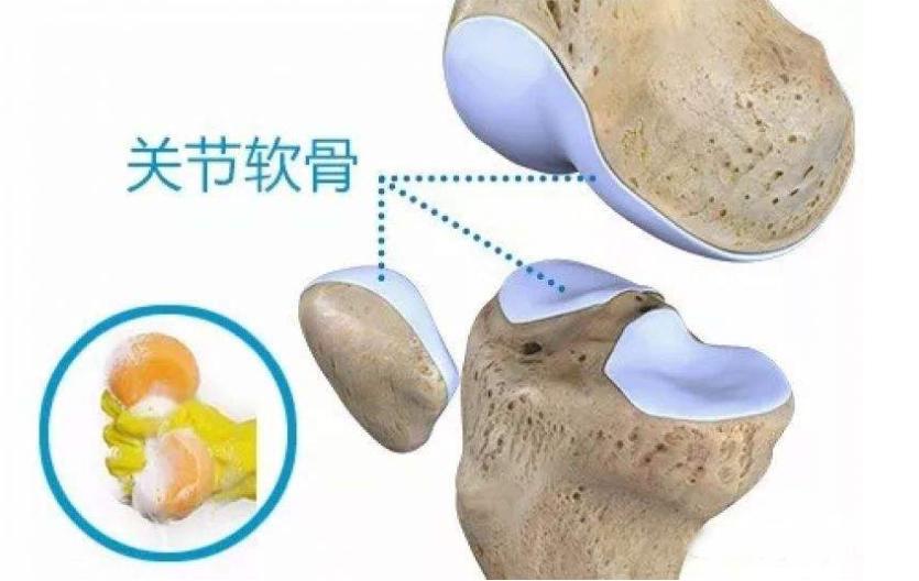 氨糖并非骨科神药,氨糖不是神药看专家怎么说