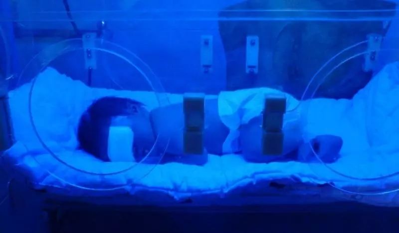 美容院的光子嫩肤是假的吗,美容院的光子嫩肤靠谱吗