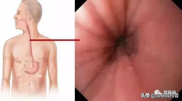 医生做胃镜检查时会看食道的吗,胃镜检查全过程视频消化内科检查