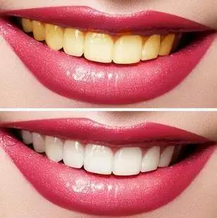 一口黄牙竟让形象尽毁！‘到手香’帮你重新找回自信！大胆开笑