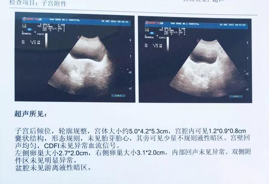 准妈妈怀孕初期都有哪些具体症状？检测怀孕的方法又有哪些呢？