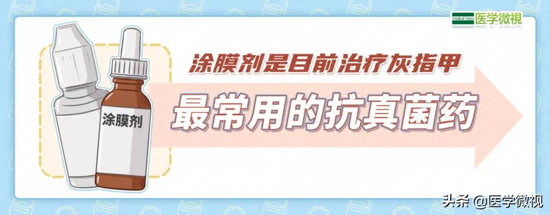 灰指甲治了半年也没治好？可能不是药的问题