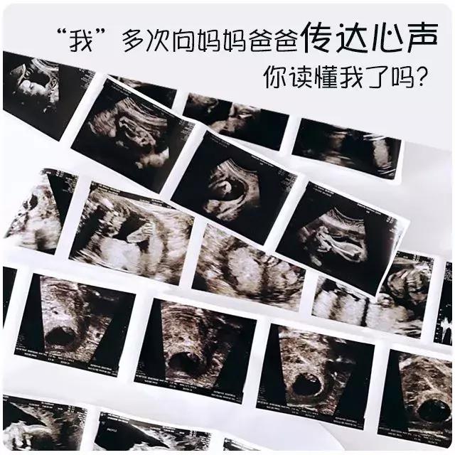 B超单的秘密，你看懂了？