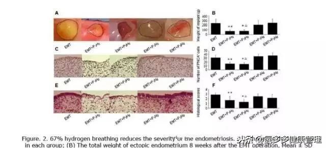 第二军医大学附属长海医院：氢气治疗子宫内膜异位症