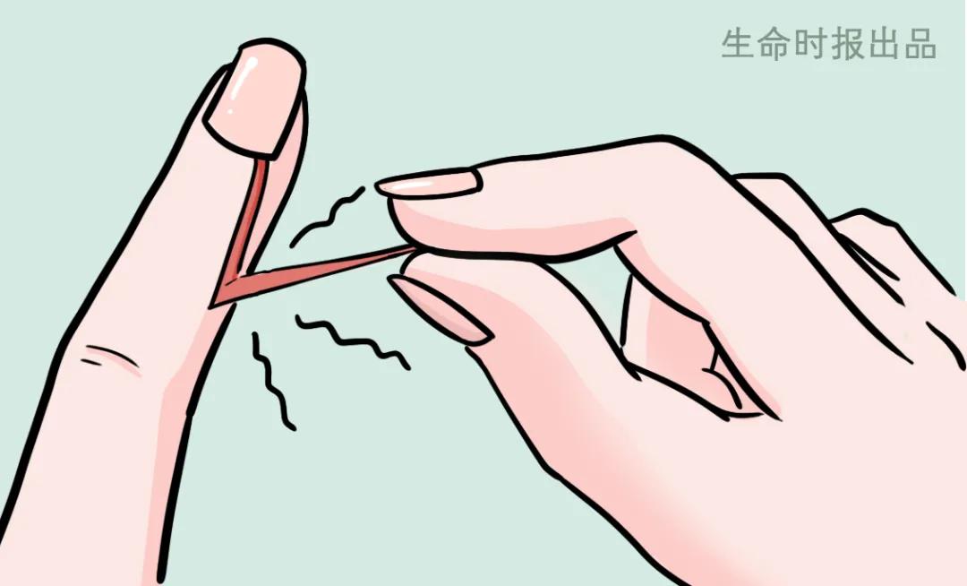 倒刺怎么去除最快方法,长倒刺怎么去除小妙招