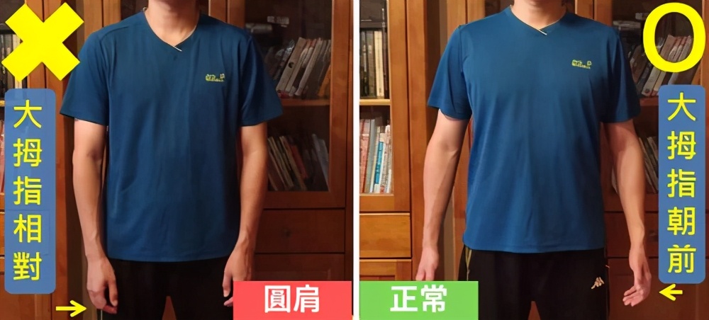 圆肩带来的影响,圆肩和正常肩的区别图片