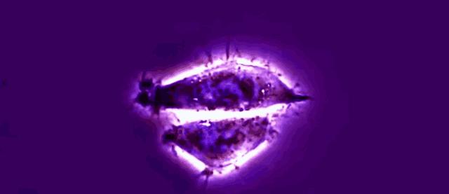 癌症细胞永生,死于癌症后细胞永生