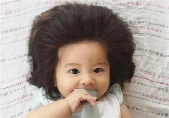 “头发多,智商高”,如何让宝宝发量赢在起跑线?这些妈妈要注意