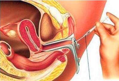 d3冻胚胎移植9天白板没希望了吗,移植2个d3胚胎的成功率