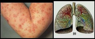 抗肿瘤药，直接影响DNA结构和功能的药物