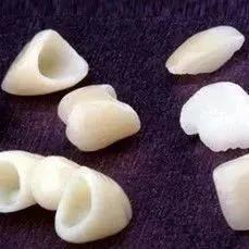 二氧化锆假牙可以做核磁吗,拿不掉的假牙可以做核磁共振么