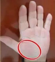 10种常见病对照表,100种常见病诊断