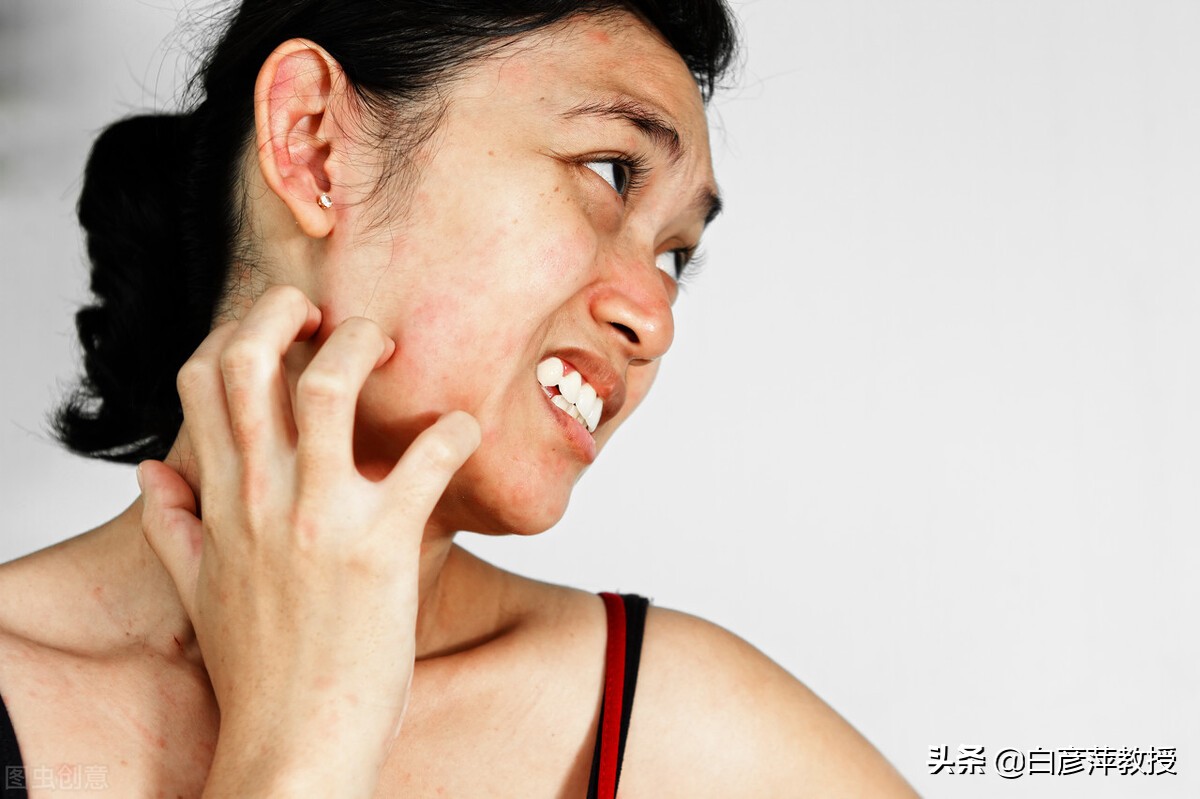 脸上的皮肤红痒肿还有点脱皮,脸上痒发红肿起皮是怎么回事