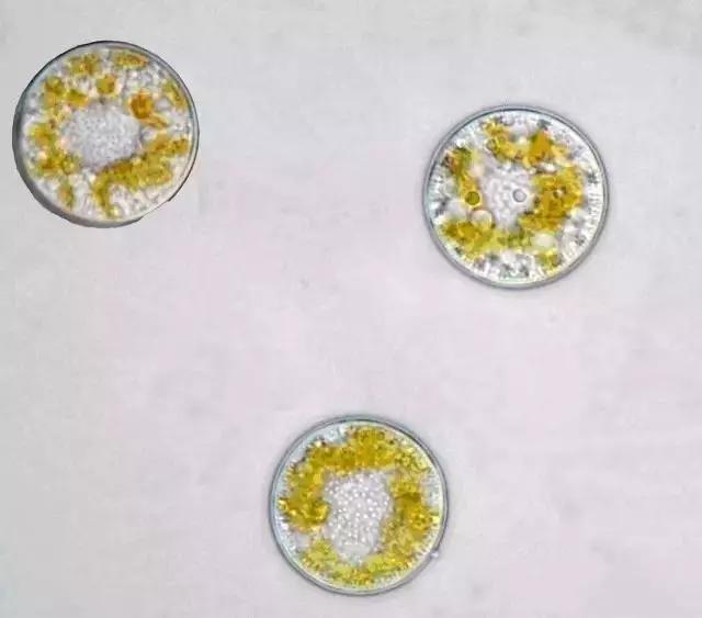 水产养殖藻类老化是怎样的,水产养殖显微镜下各种藻类