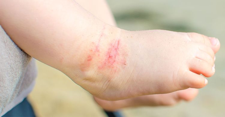 宝宝湿巾真的不能用吗 (宝宝专用的湿巾可以长期使用吗)