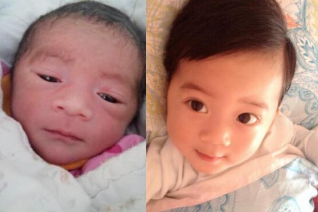 有种整容式成长叫甜馨,有一种整容叫长大后