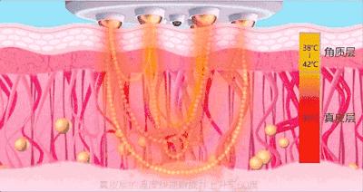 王鸥谈打了瘦脸针,王鸥打过瘦脸针吗